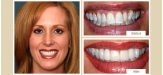 smile-gallery